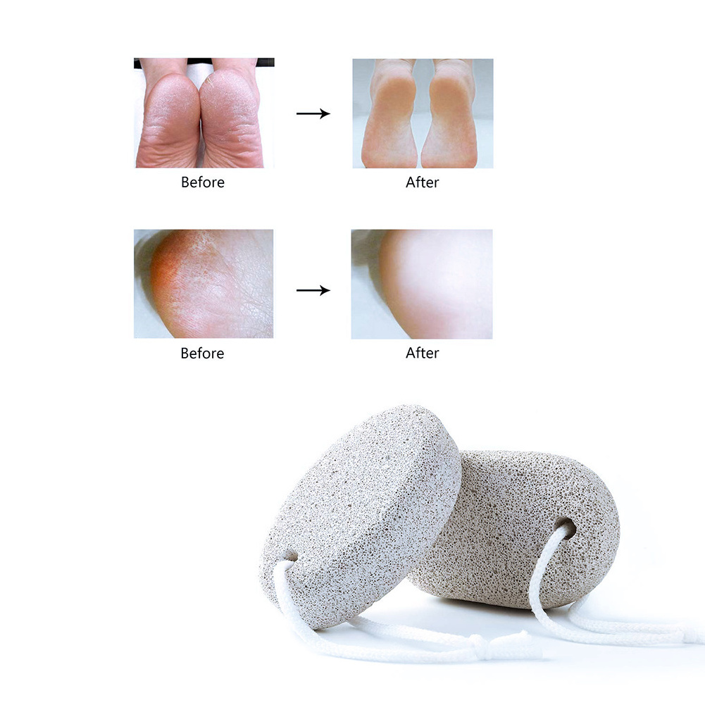 Natural Pumice Stone for Feet Lava Pedicure Tools Hard Skin Callus Remover Foot File Stone for Feet and Hands