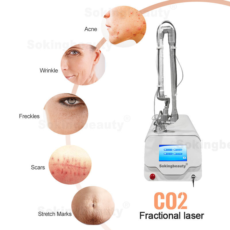 Fractional Co2 Laser Scar Removal Acne Hole Co2 Laser Vaginal Laser Co2 Fraccionado