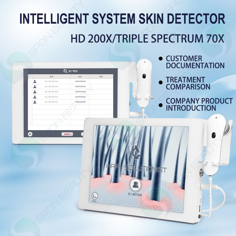 High Quality HD Hair Follicles Scalp Scanner Detector Hair Analyzer / Skin And Scalp Hair Analysis Machine