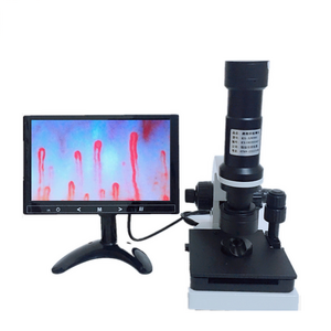 Digital Microscope Nailfold Capillary Microcirculation Detector Illuminated USB Microscope Nail Fold Instrument 9'' LCD Display