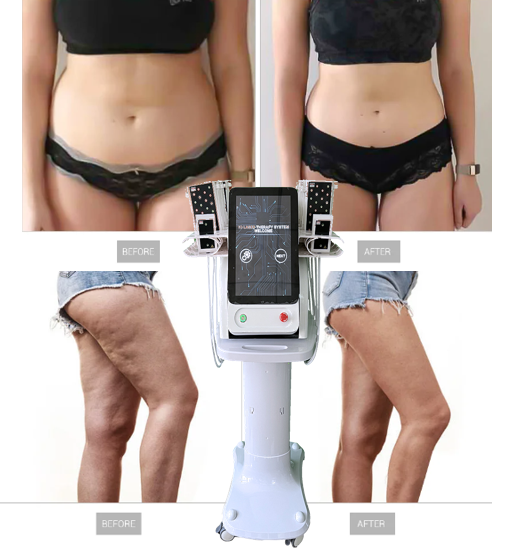 2024 Powerful Weight Loss Body Contouring Lipo Fat Burning Cellulite Body Shape Slimming Spa Machine