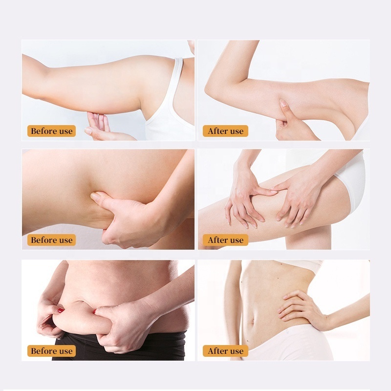 Private Label Weight Loss For Tummy Face Body Belly Burn Fat Burning Shaping Waist Hot Slimming Cellulite Slim Cream