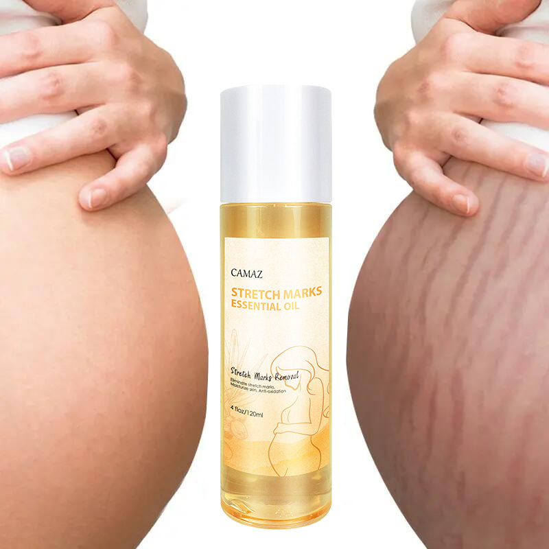 private label stretch marks essential oil scar oil belly abdomen leg 100% natural stretch mark removal oil for women