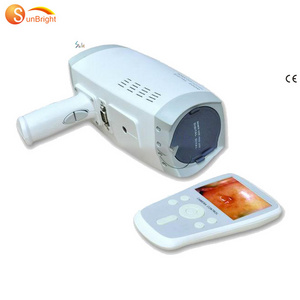 Digital Electronic Vagina Video Colposcope camera for Gynaecology scanning machine