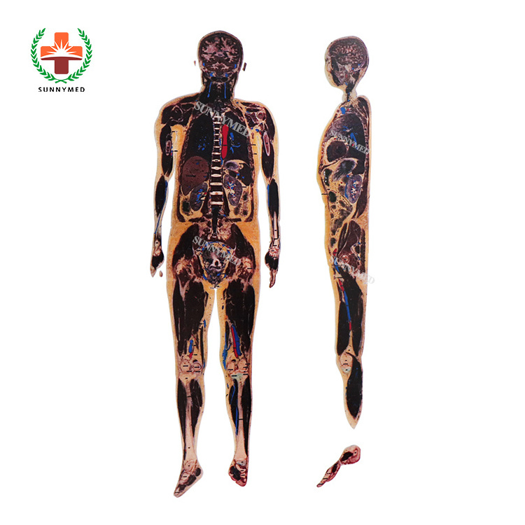 SY-YU03 Digital Human Anatomy System Anatomage 3D body Virtual Autopsy Table for School