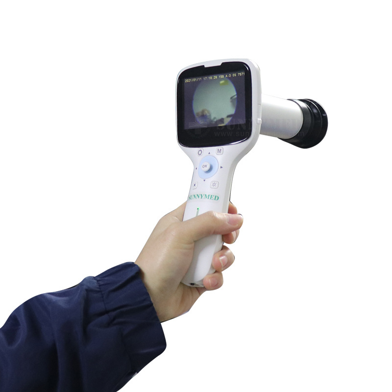 SY-V042N New medical device easy operation eyes portable fundus camera