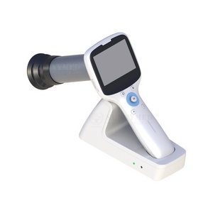 SY-V042N Sunnymed hand-held eye fundus camera ophthalmic digital fundus camera for sale