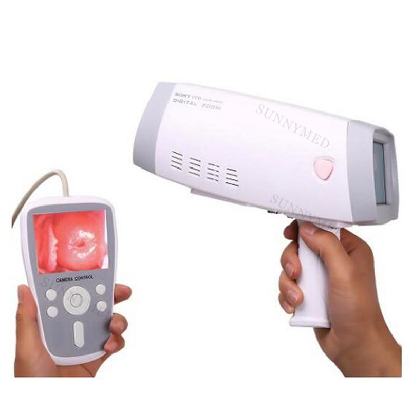 SY-F005 Gynecology Digital Electronic Colposcopy Video Colposcopio Digital Camera Video Colposcope