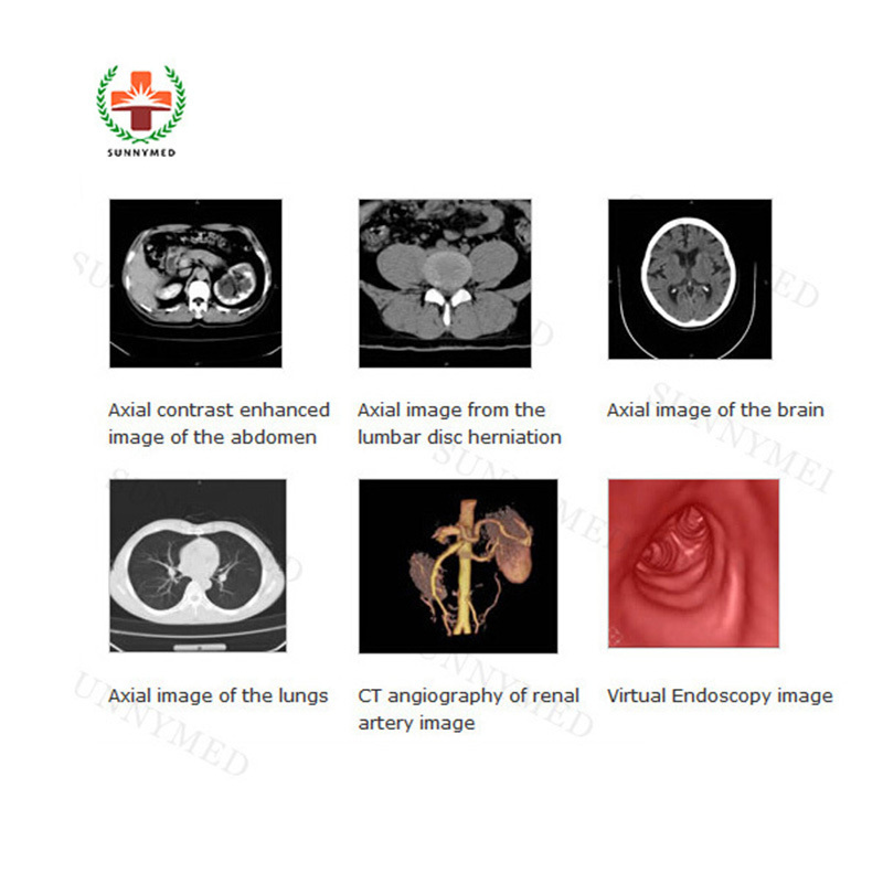 Hospital Medical Equipment medical Dual-slice scanner System MRI Scan price MRI scanner Equipment 16 slice ct scanner machine