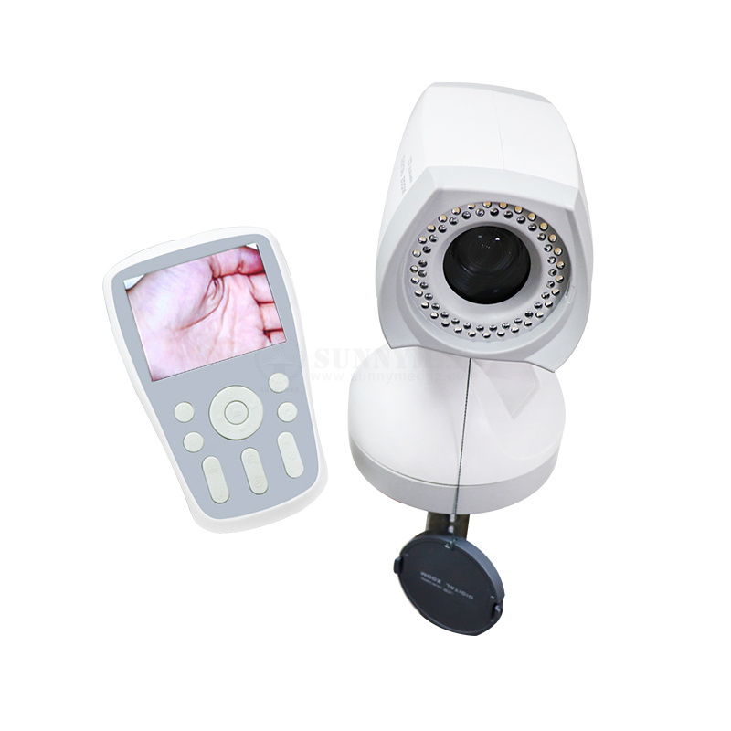 SY-F005 Portable Digital Colposcope Camera Video Colposcope