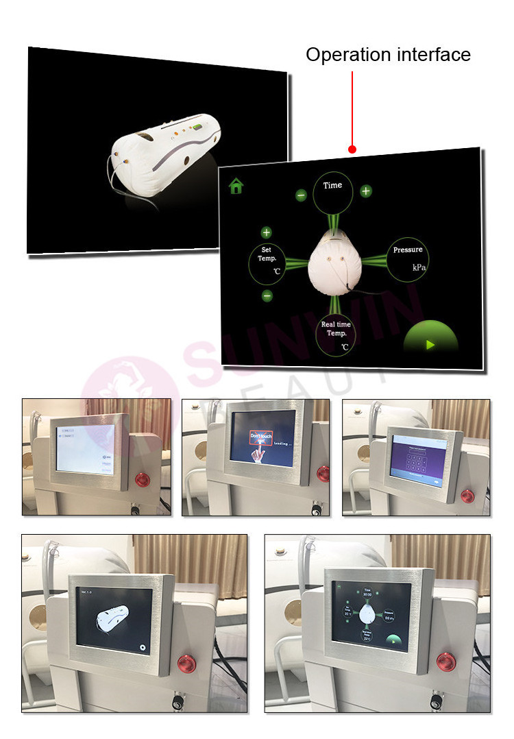 Medical Home Hbot Hyperbaric Oxygen Therapy Camara Hiperbaricas 1.5ata 1.3 Ata Hyperbaric Chamber Cancer Brain Damage