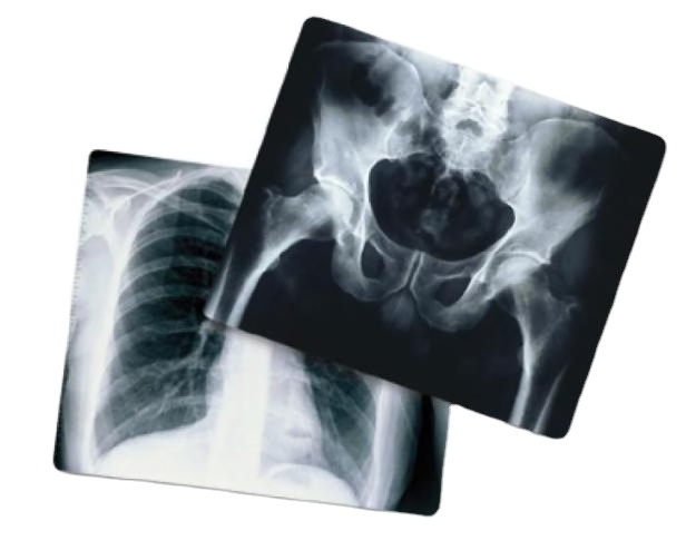 High quality medical X ray blue film dental x ray film for DR/CR/CT