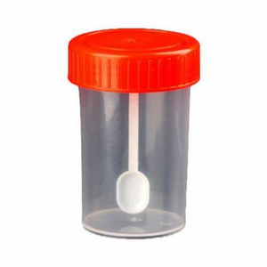 High quality stool sample container for stool specimen collection disposable medical consumable