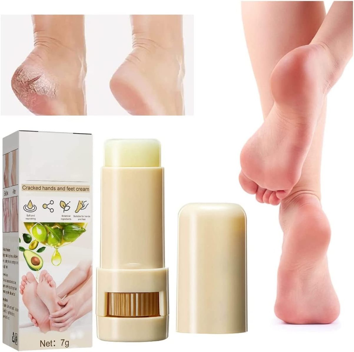 1pc Cracked Hand Foot Care Salve Anti Dry Cracked Swollen Itchy Heels Peeling and Dead Skin Moisturizing for Rough Dry and Crack