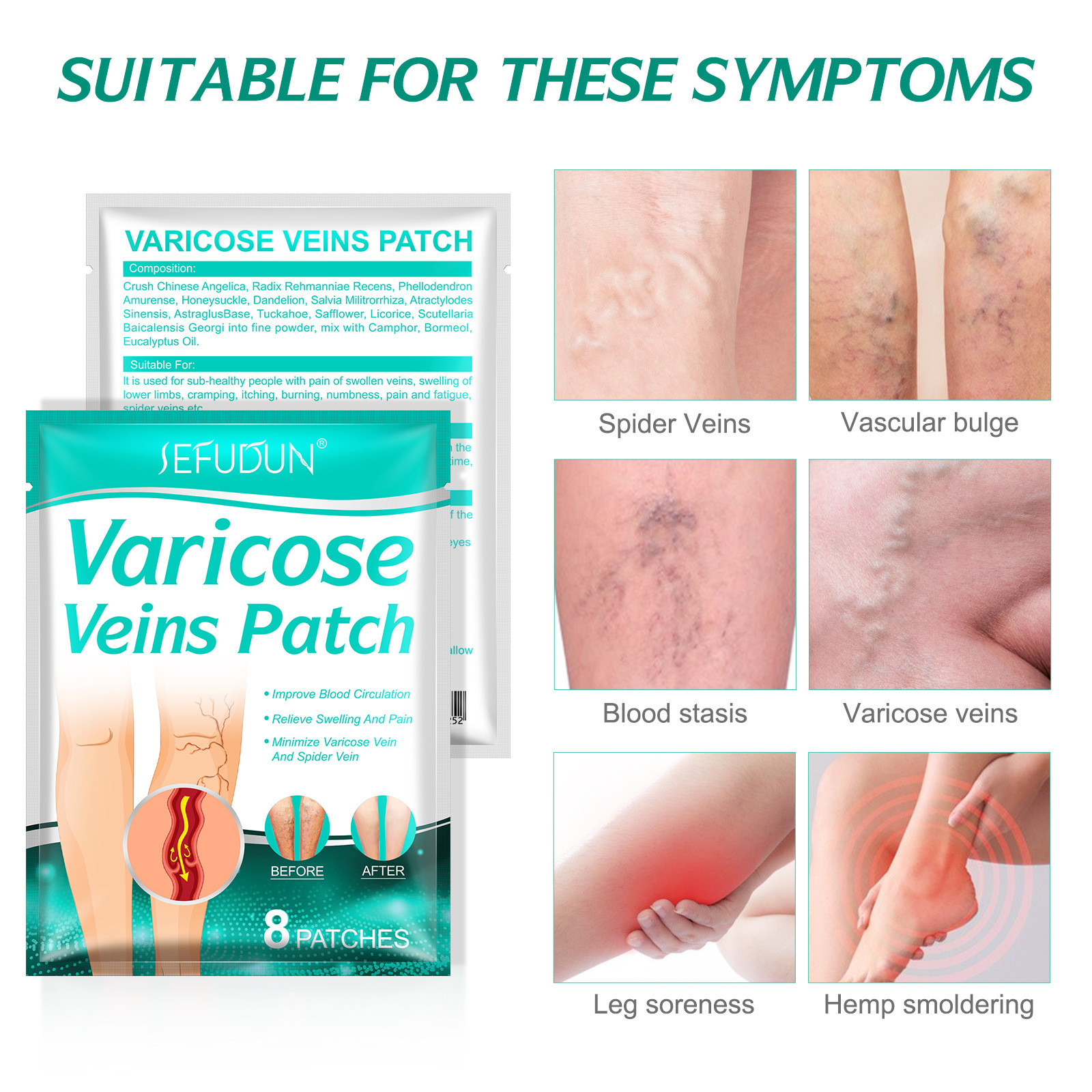 OEM Varicose Veins Patch Relief Leg Pain Strengthens Capillary Health Improve Blood Circulation Varicose Veins Treatment Paste