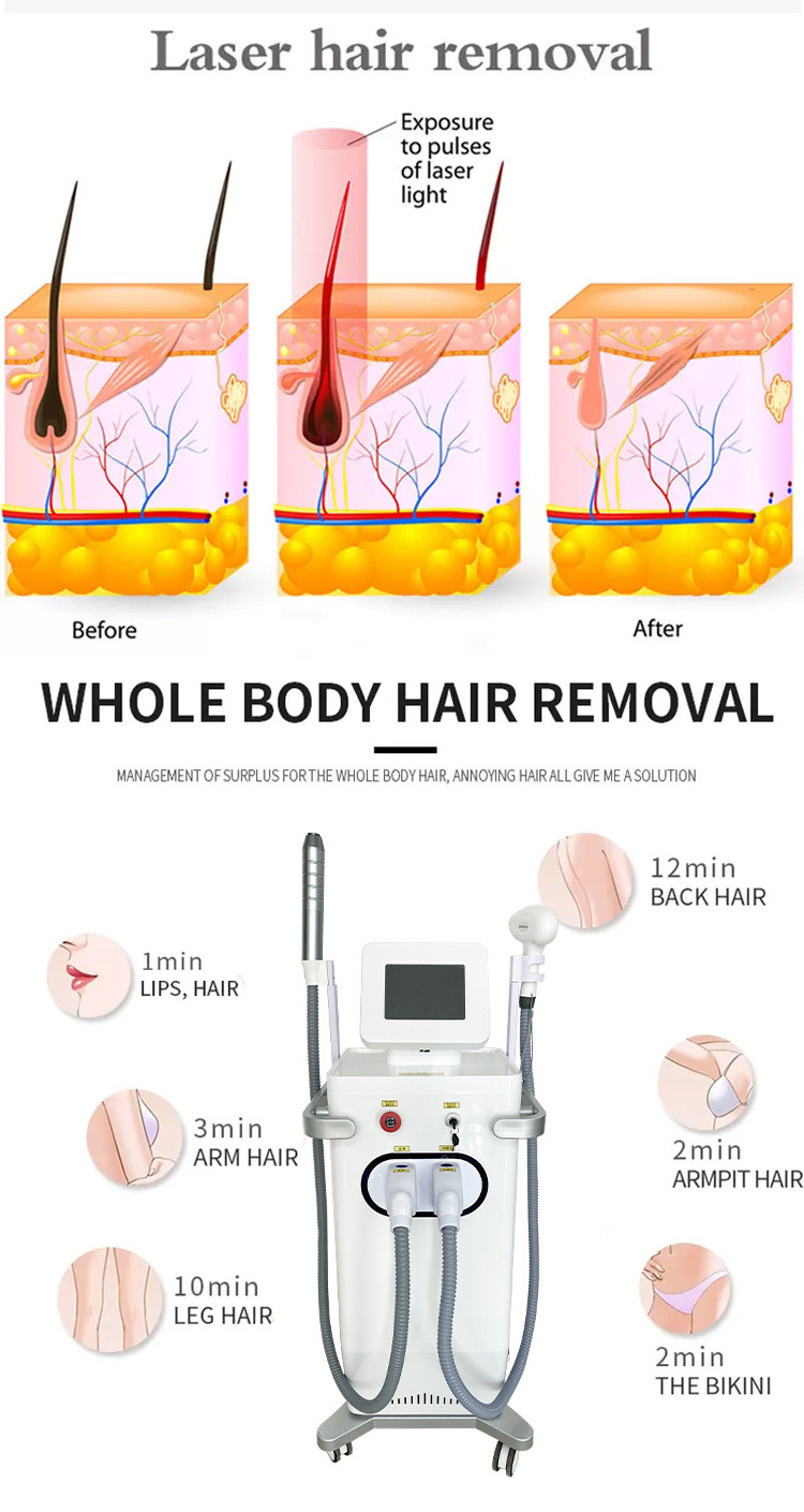 2023 New Products Wax Machine For Hair Removal Price Professional Laser Hair Removal Machine For Face And Body Hair Removal Mach