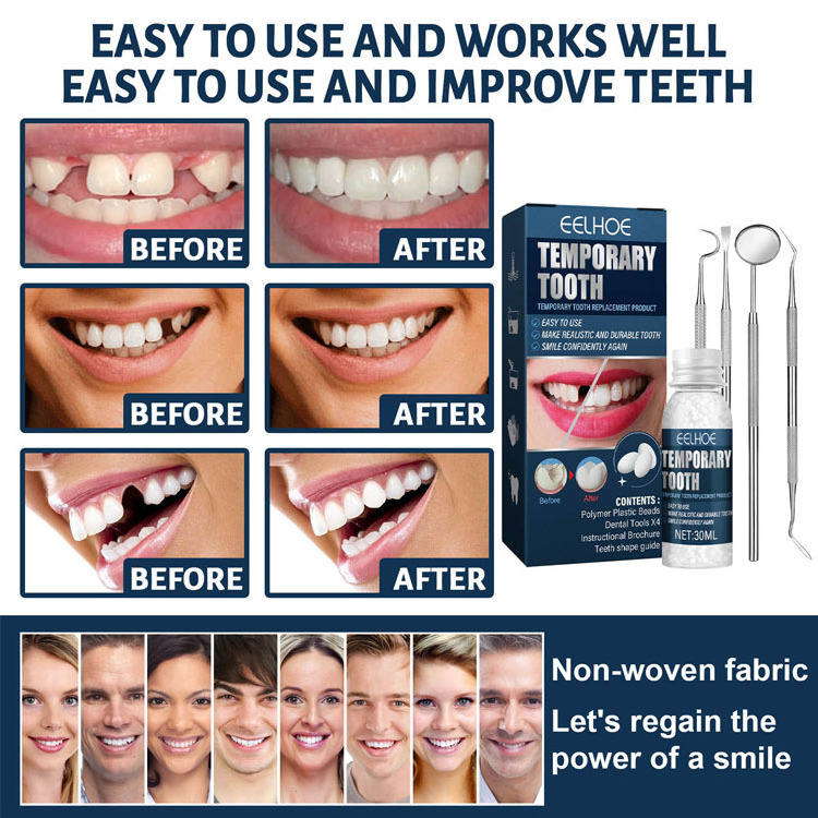 Eelhoe Temporary Tooth Repair Set Solid Denture Adhesive Glue DIY Teeth Glue Missing Broken Lost Moldable Repair Tooth Gap Tool