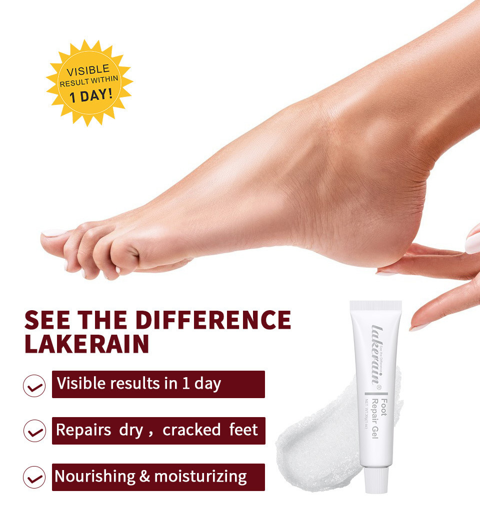 Private Label Foot Repairing And Dead Skin Remover Best Relaxing Smoothing Ultimate Callus Remover Gel