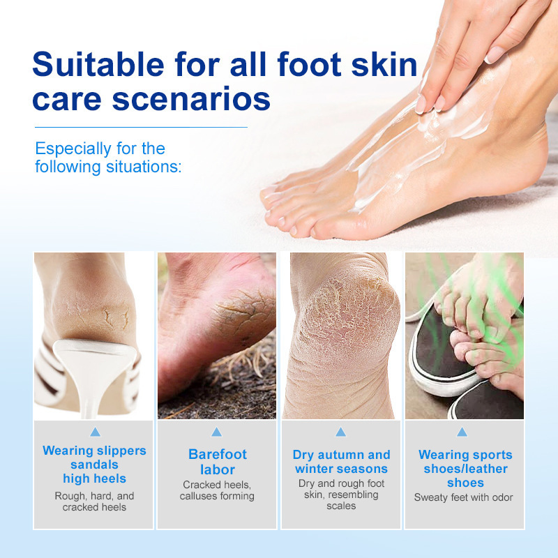 Hot Sale JoyPretty 42% Urea Foot Cream Soften Skin Hydrating Exfoliating Foot Care Cream Repairs Rough and Cracked Feet