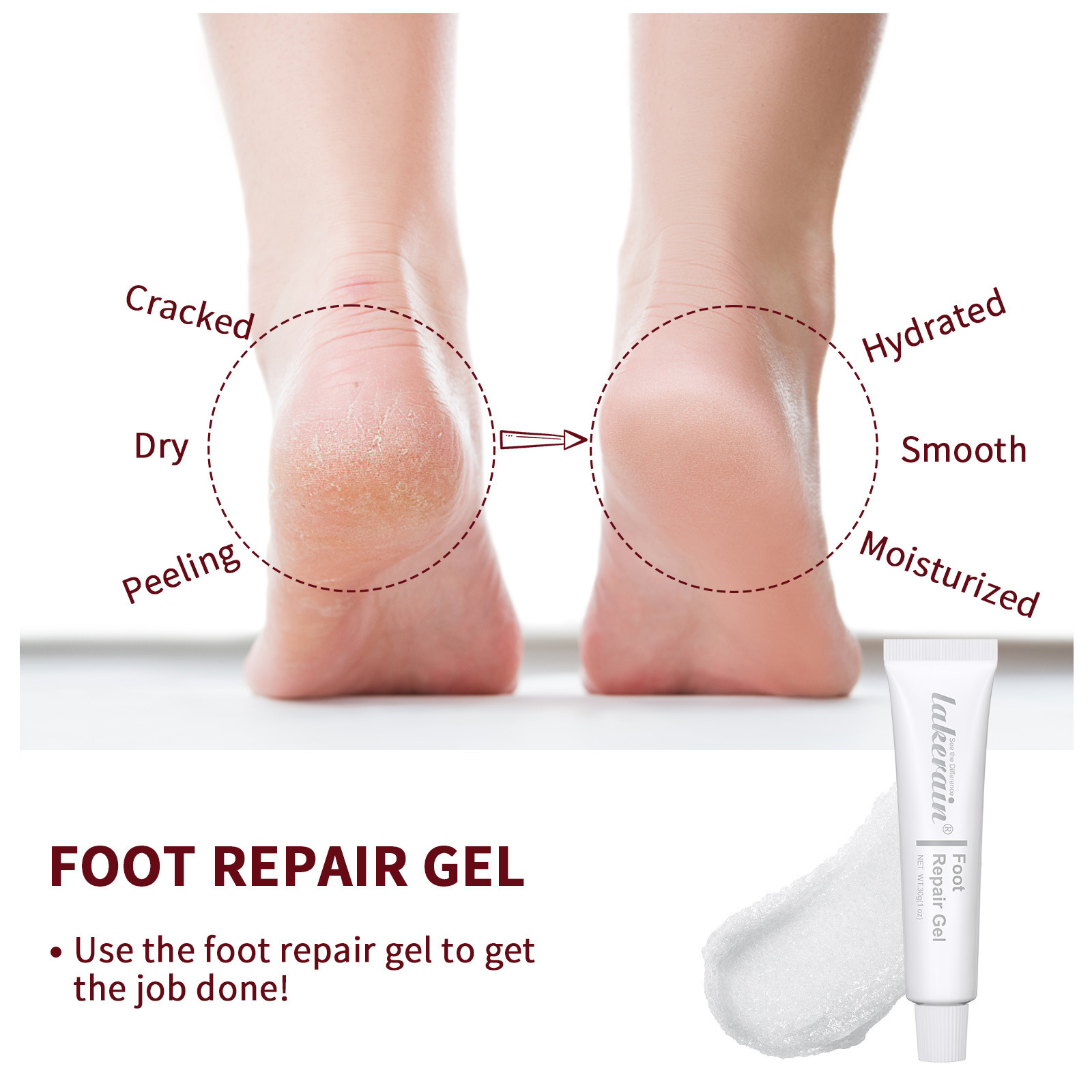 Private Label Foot Repairing And Dead Skin Remover Best Relaxing Smoothing Ultimate Callus Remover Gel