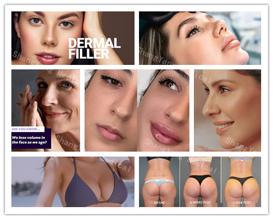 REJEON dermal fillers for the butt face injection 2ml placenta stem cell  hyaluronic acid gel injectable nose filler injection