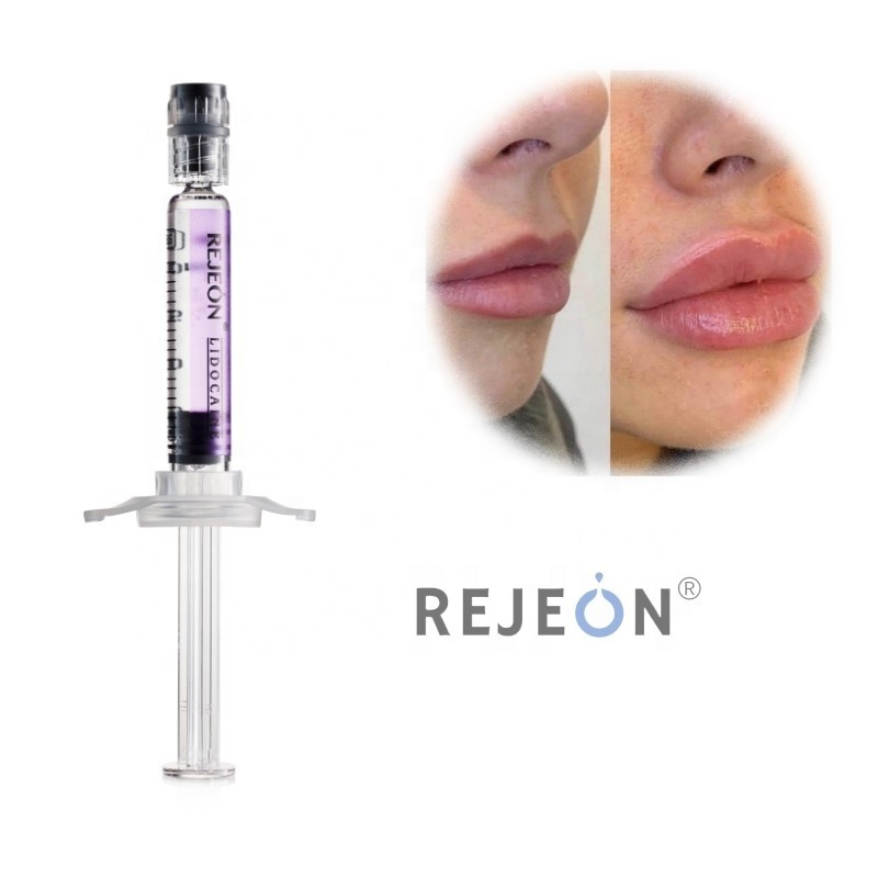 REJEON Dermal Filler Gel Lip Filler Stylage Injectable Dermal Filler With Needle