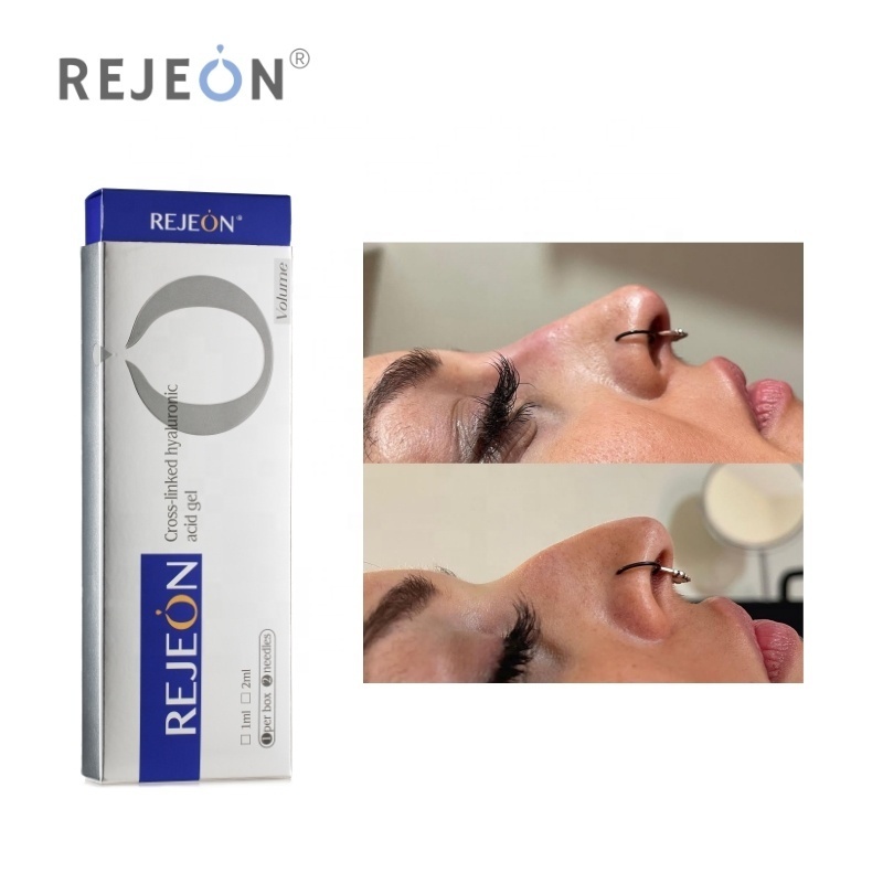 REJEON Dermal Filler Gel Lip Filler Stylage Injectable Dermal Filler With Needle