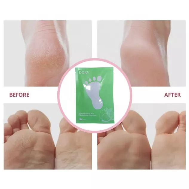 Oem Private Label Natural Herbal Foot Skin Care Lime Moisturizing Exfoliating And Rejuvenating Peeling Off Foot Mask For Women