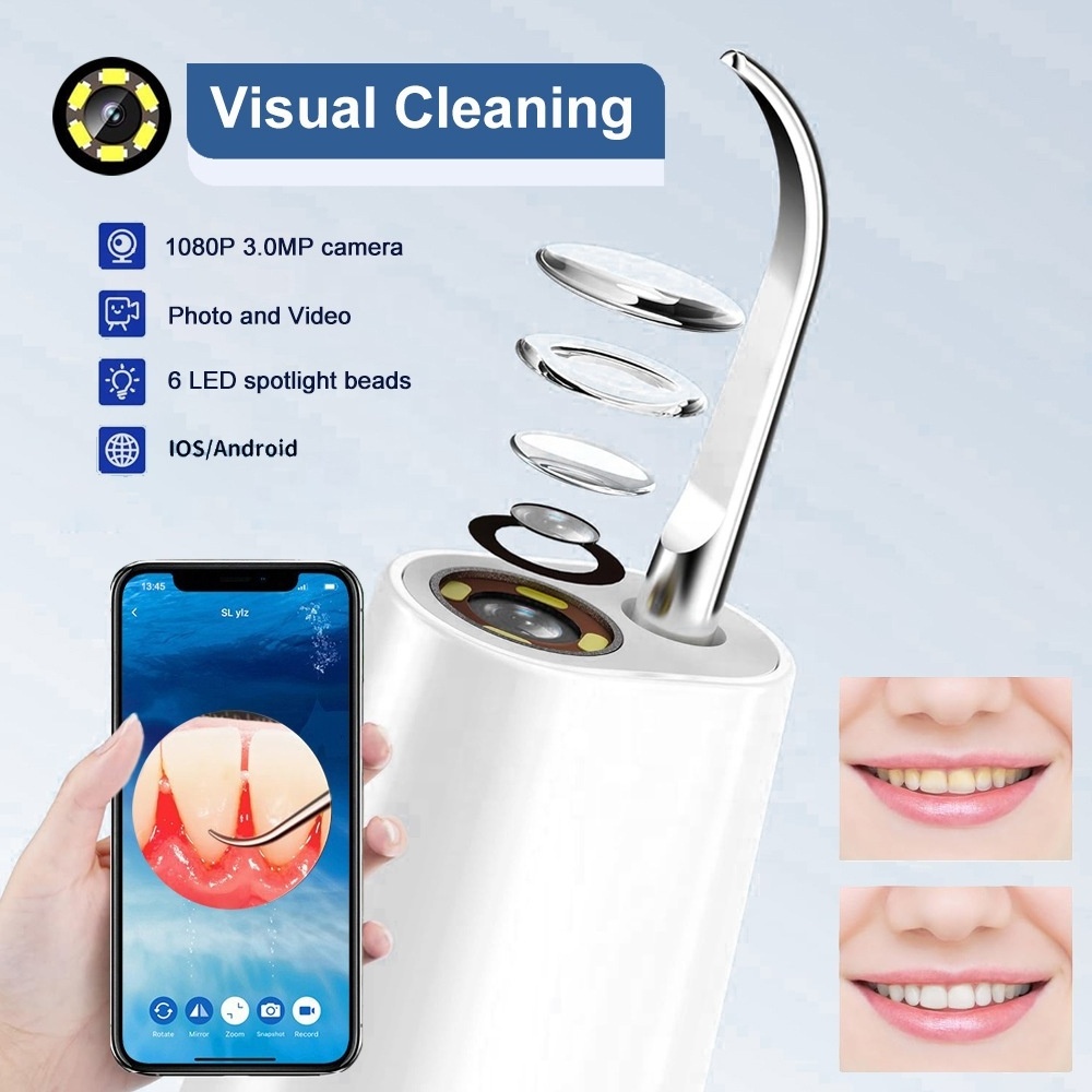 Portable Visual Dental Plaque Calculus Remover Ultrasonic Electric Tooth Cleaner Oral Care Hygiene Teeth Cleaning Tool