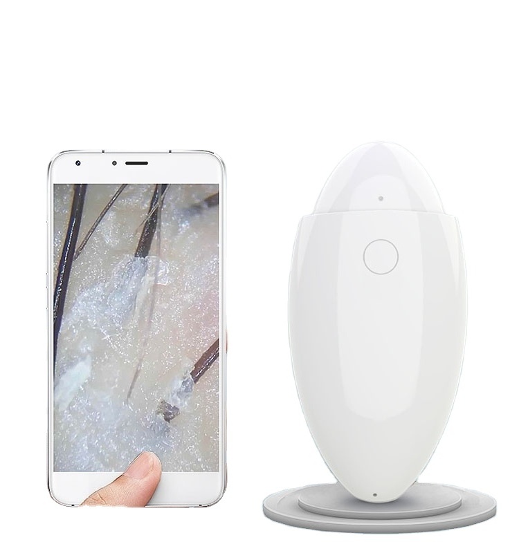 Wireless scalp scanner camera 500X HD hair follicle hair skin analyzer to take photos and video analysis