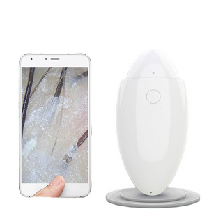 Wireless scalp scanner camera 500X HD hair follicle hair skin analyzer to take photos and video analysis