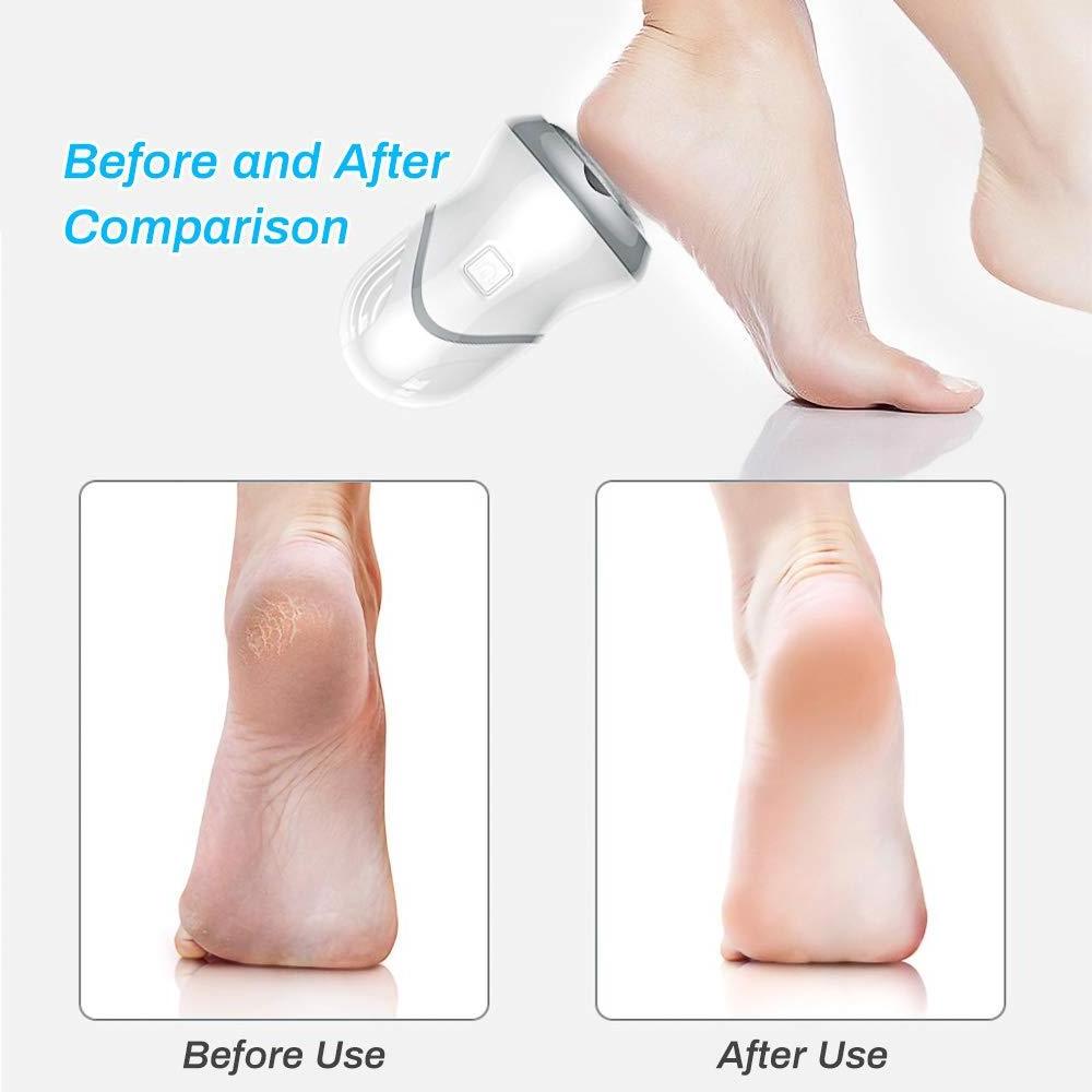 Portable Foot Vacuum Grinder Electric Callus Remover for Feet Vacuum Callus Collector and Remover Tool