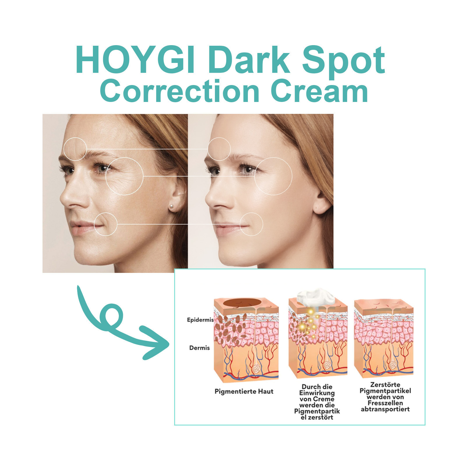 HOYGI black spot facial cream fading spots skin firming wrinkles moisturizing anti-wrinkle skin care facial cream 20g