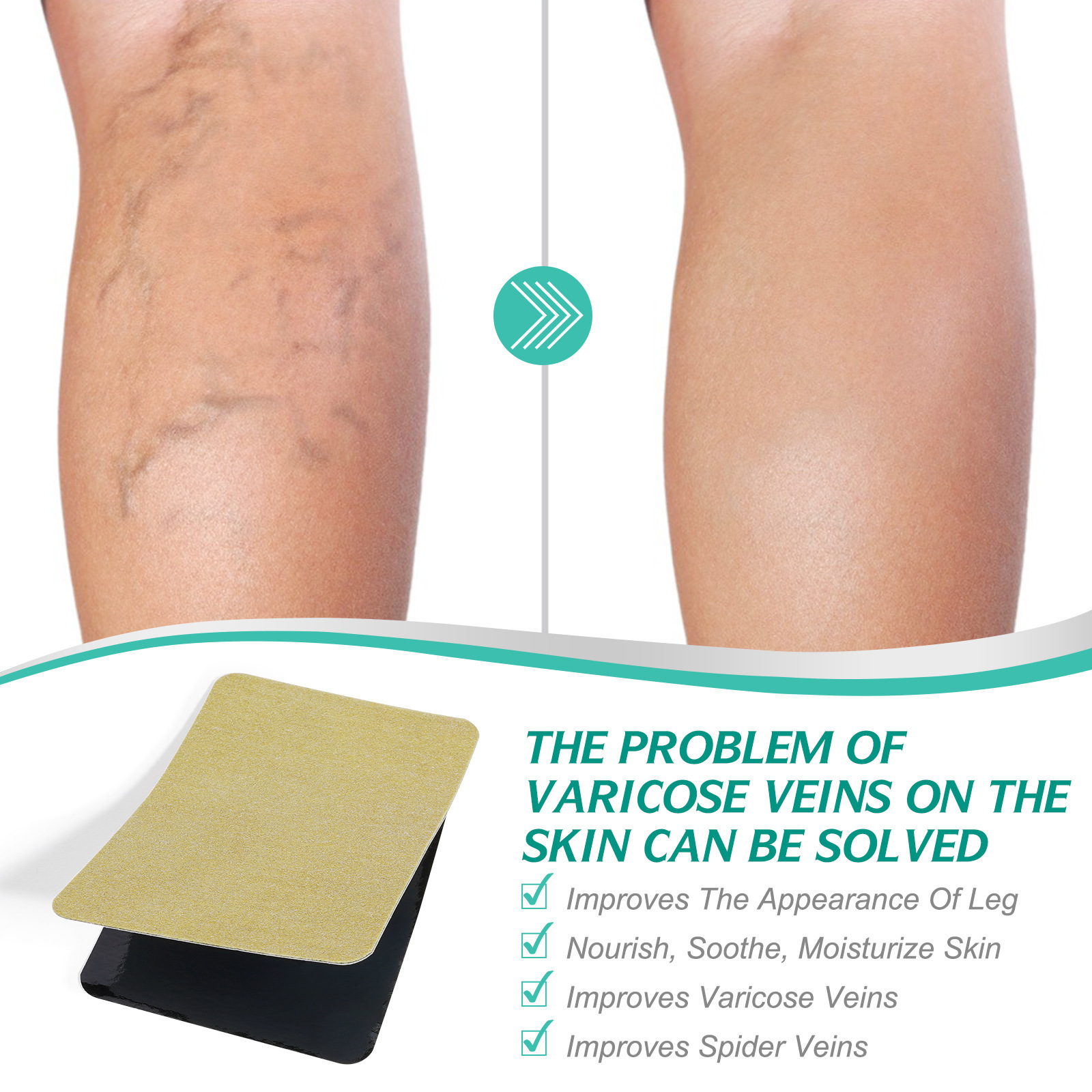 Health Care Relieve Varicose Veins And Swelling Spider Veins Treatment Patch Therapy Herbal Varicose Veins Patch