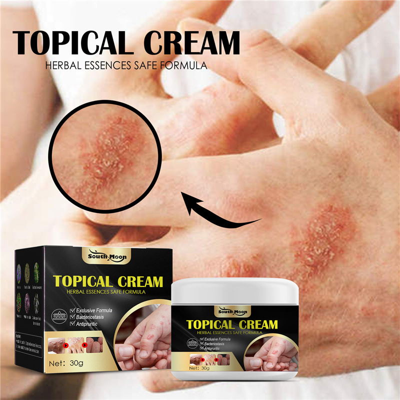 South Moon topical cream sweat blister mosquito bite dry itching skin repairing cream hand foot antipruritic cream