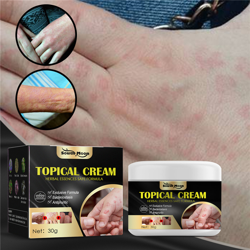 South Moon topical cream sweat blister mosquito bite dry itching skin repairing cream hand foot antipruritic cream