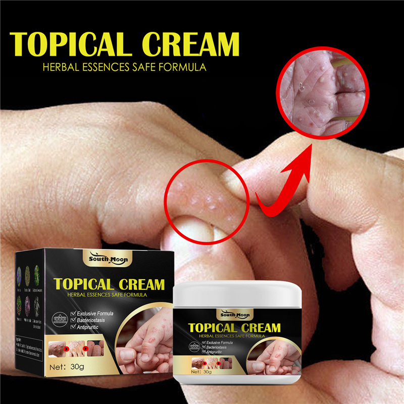 South Moon topical cream sweat blister mosquito bite dry itching skin repairing cream hand foot antipruritic cream