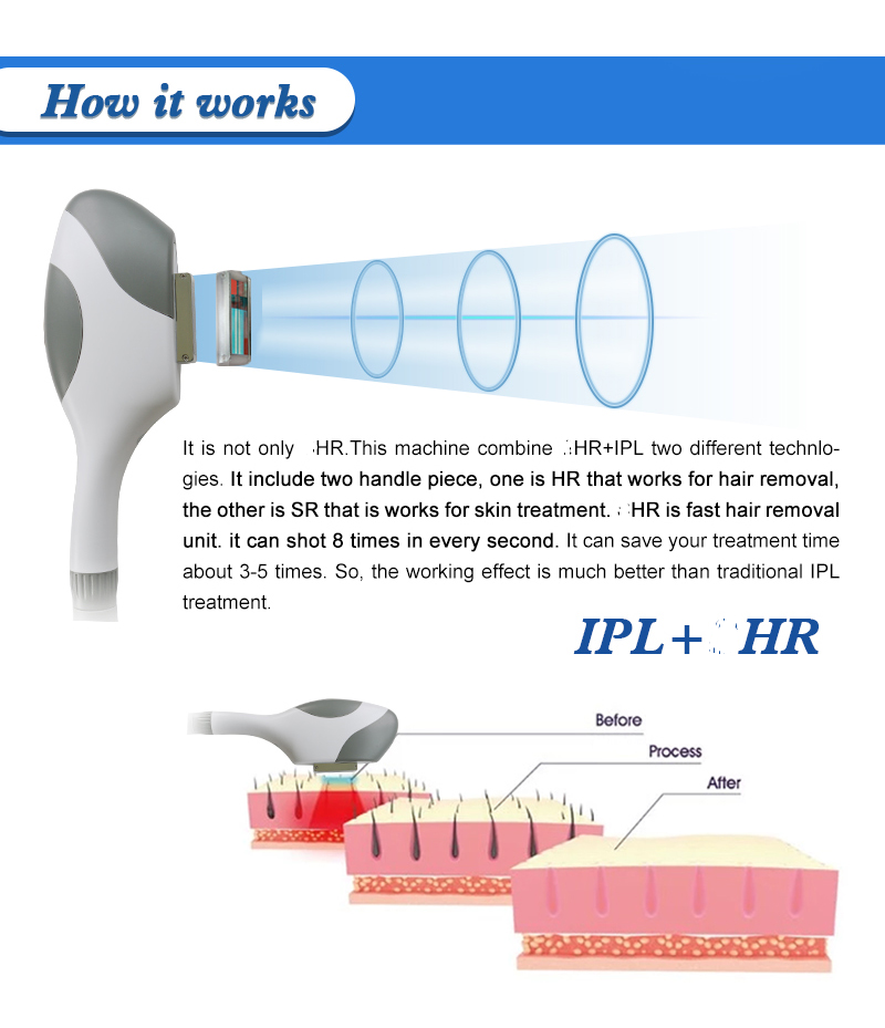 Ipl Skin Rejuvenation Machine/Ipl Multi Function Handset Home Use Skin/IPL Hair Removal Beauty Equipment