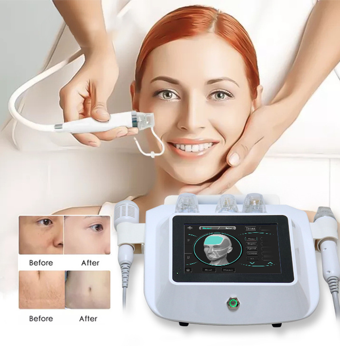 New Technology RF Micro Needling Facial Skin Beauty Treatment Machine Gold RF Microneedle Face lift