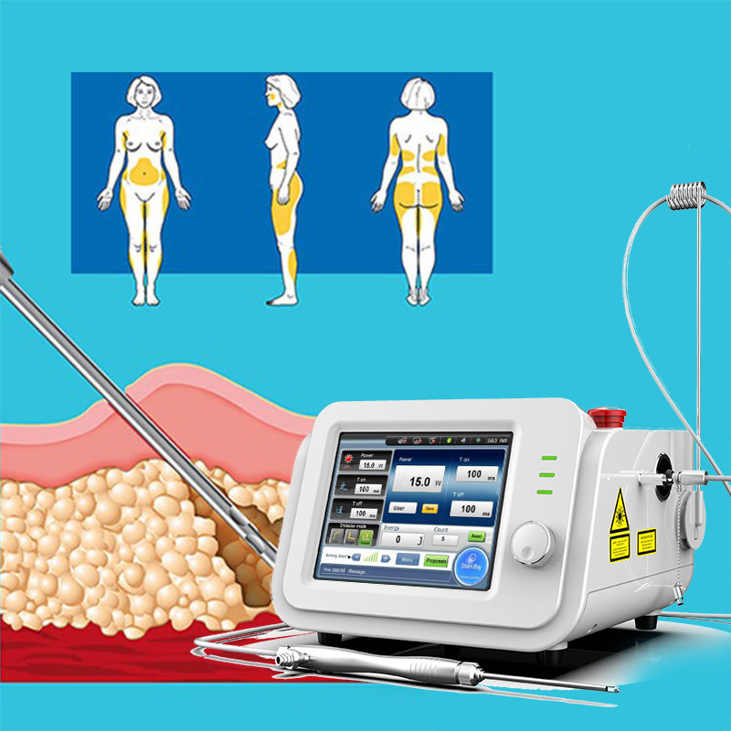 best slimming 980nm vaser liposuction machine 1470nm laser lipolysis lipo laser fat removal beauty machine