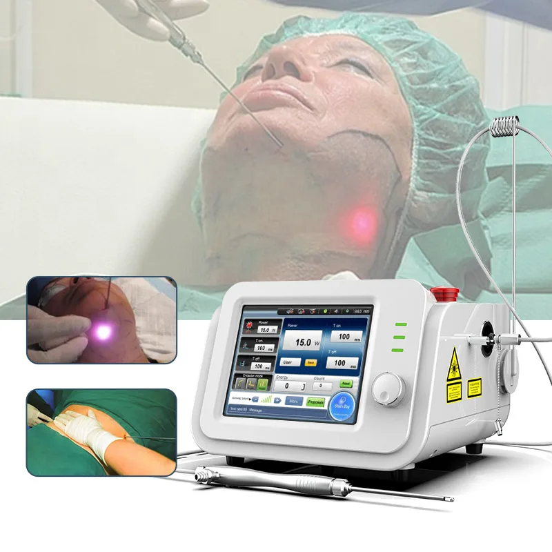 Diode Laser Liposuction cannula laser /980nm lipolysis liposuction laser machine for sale /surgical laser liposuction machine