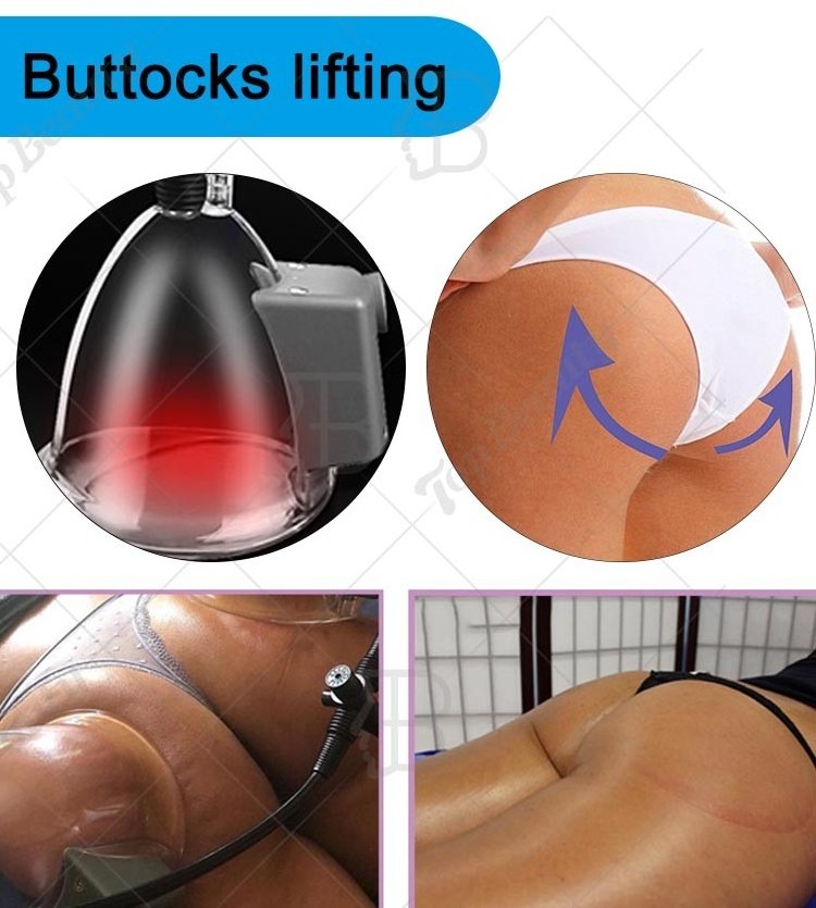 Vacuum Butt Lift Machine Breast Lift Buttocks Enhancement Equipment With Cup Vacuum Therapy Lifting Colombian For Beauty Machine