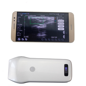 Wholesale wireless ultrasound probe portable Handheld wifi ultrasound probe transducer Custom 3 in 1 linear ultrasound probe