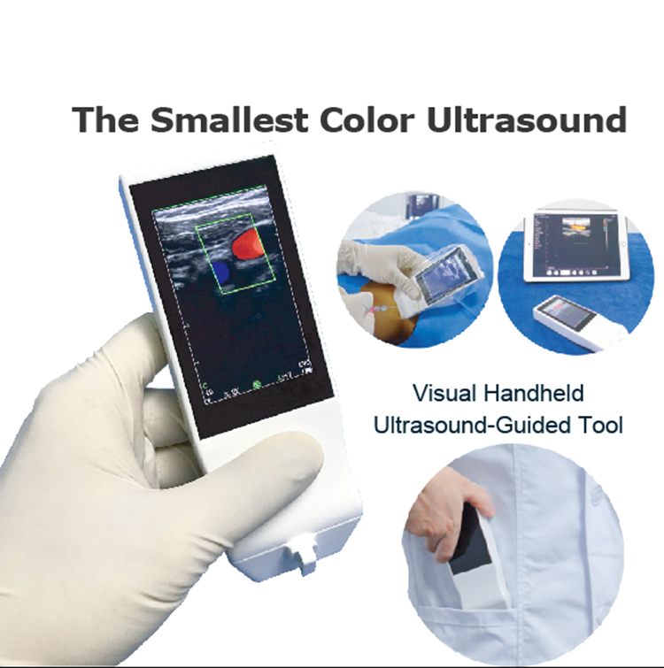 Wholesale wireless ultrasound probe portable Handheld wifi ultrasound probe transducer Custom 3 in 1 linear ultrasound probe