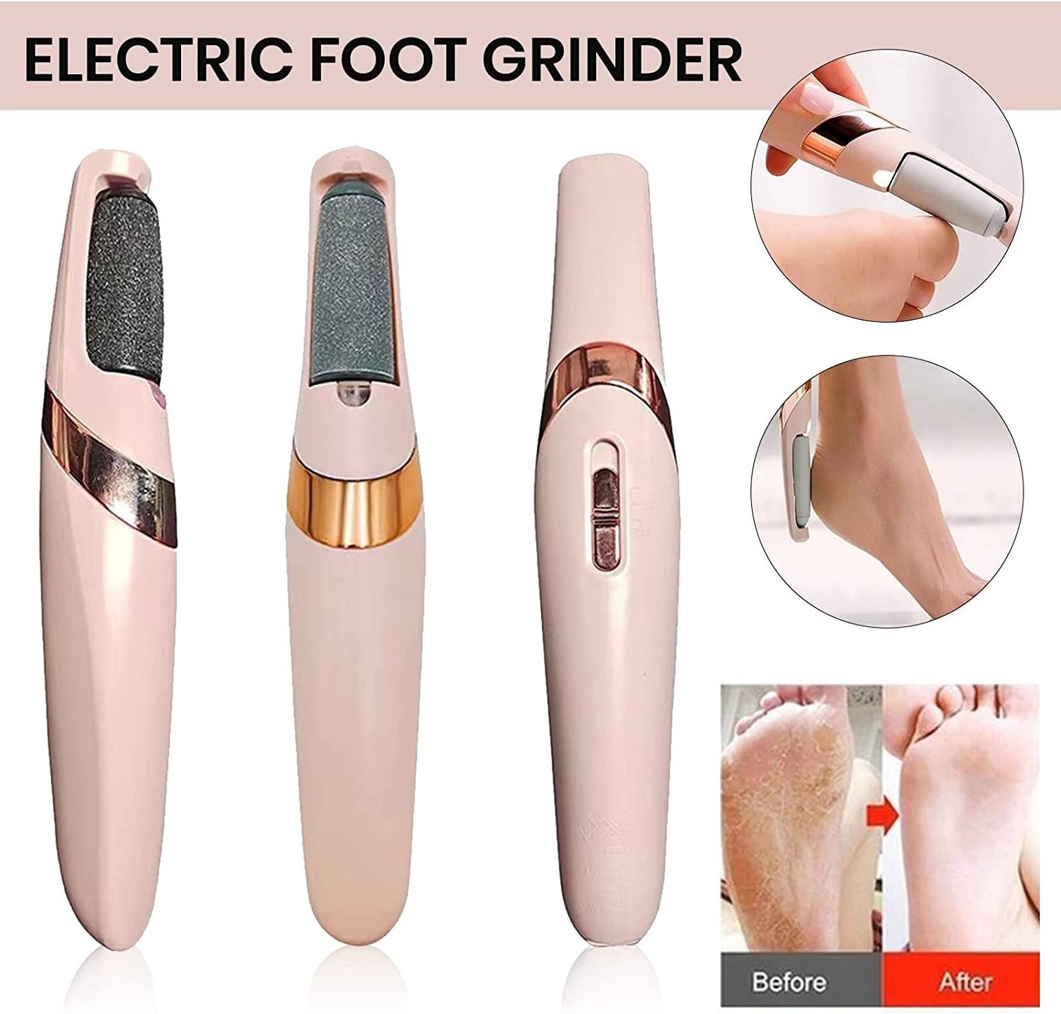 Foot Scrubber Scraper File Dead Skin Callus Remover File Foot Callus Remover Foot Care Tool Pedicure Machine