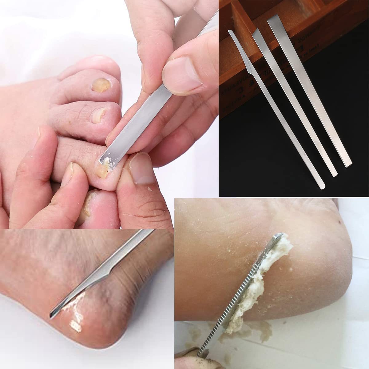 3pcs Stainless Steel Ingrown Toenail Pedicure Set Pedicure Knife Foot File Scraper