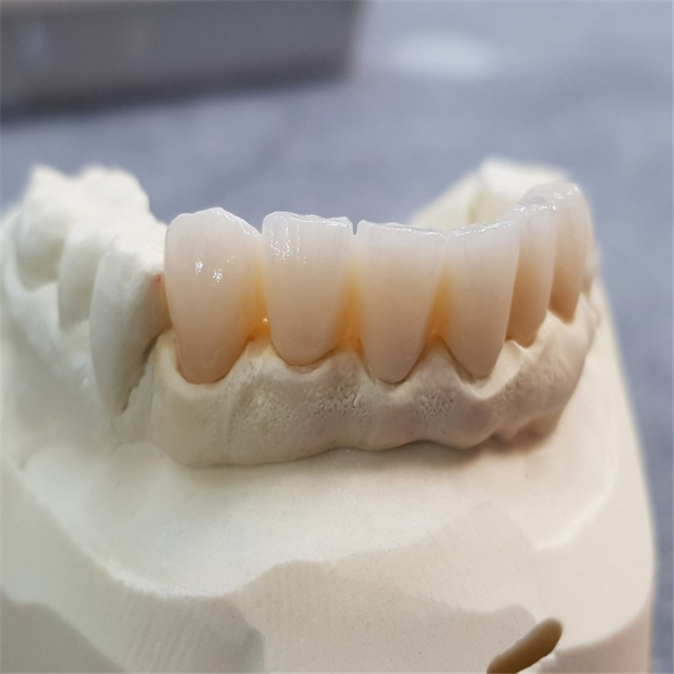 dental zirconia block 3D multilayer for cadcam milling machine denture material zirconia disc