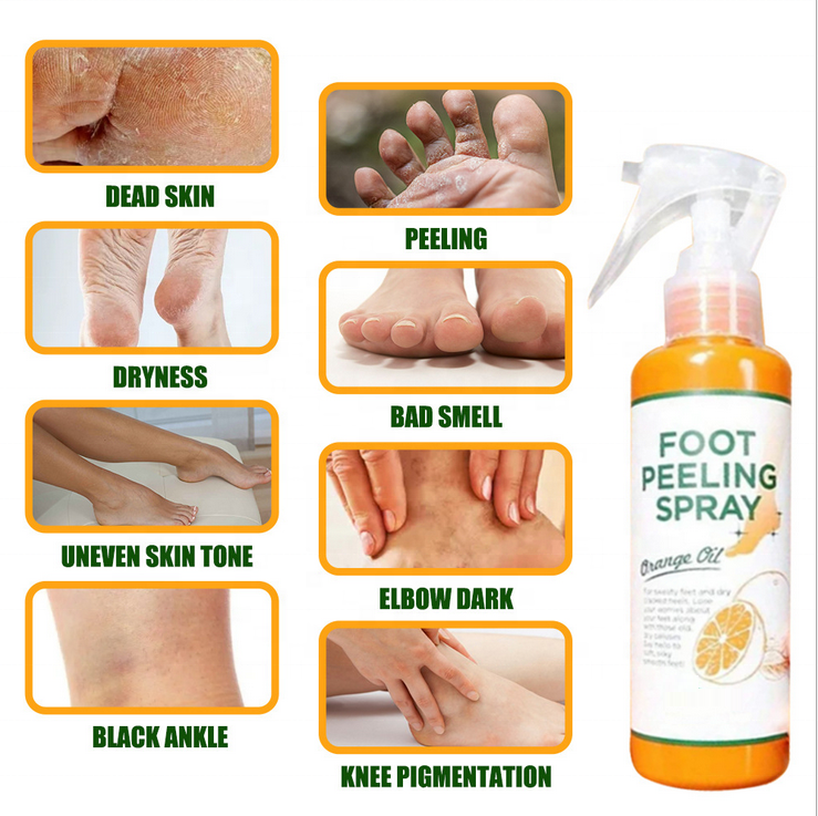 Private Label EKBER Dark Skin Care Remove Dead Skin Exfoliating Product Foot Peeling Spray For Baby Soft Feet