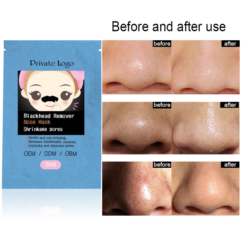 Private Label Black Head Nasal Patch To Remove Blackhead Acne Nasal Membrane Bamboo Charcoal Nose Mask Strip