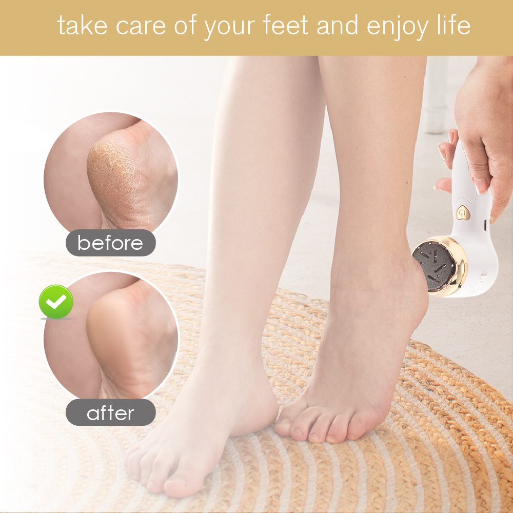 Electric Vacuum Callus Remover Rechargeable Portable Electronic Foot File Dead Skin Callus Remover